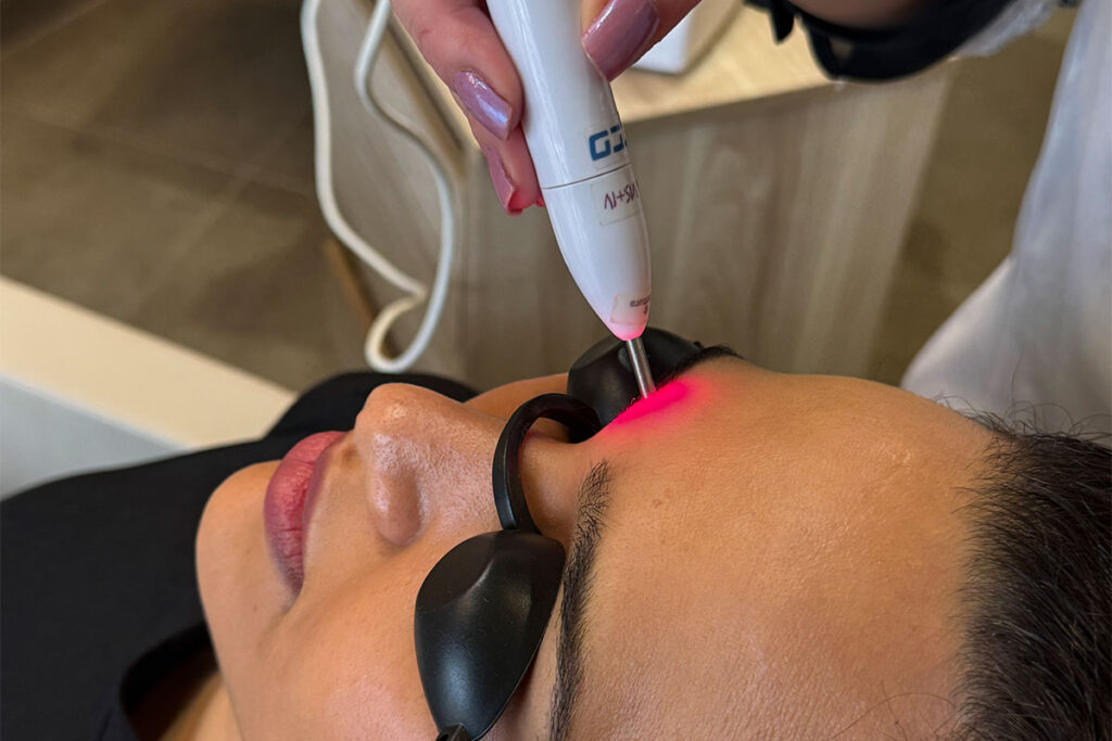 Tratamento para sobrancelhas | Tica Terapia Capilar em Campinas